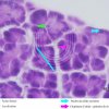 Glândula Alveolar Composta - Pâncreas 100x